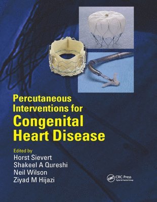 Percutaneous Interventions for Congenital Heart Disease 1