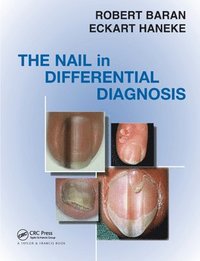 bokomslag Nail in Differential Diagnosis