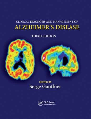 bokomslag Clinical Diagnosis and Management of Alzheimer's Disease