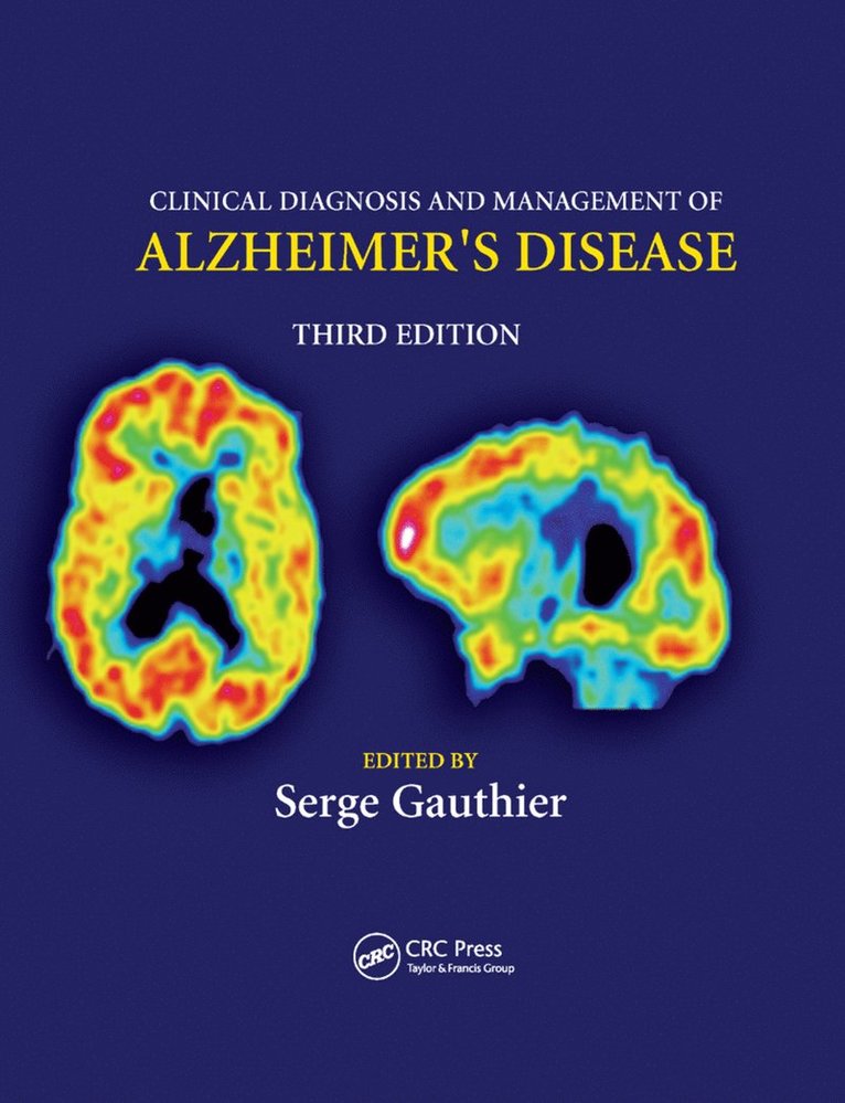 Clinical Diagnosis and Management of Alzheimer's Disease 1