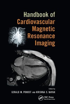 Gerald M. Pohost, Krishna S. Nayak - Handbook of Cardiovascular Magnetic Resonance Imaging, Häftad