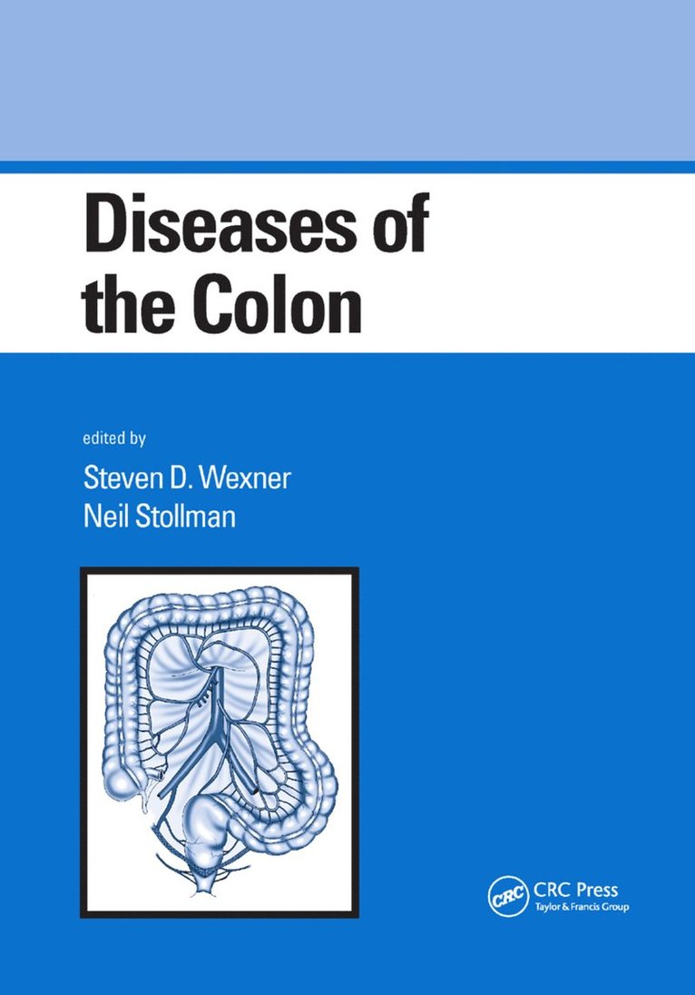 Steven D. Wexner, Neil Stollman - Diseases of the Colon, Häftad