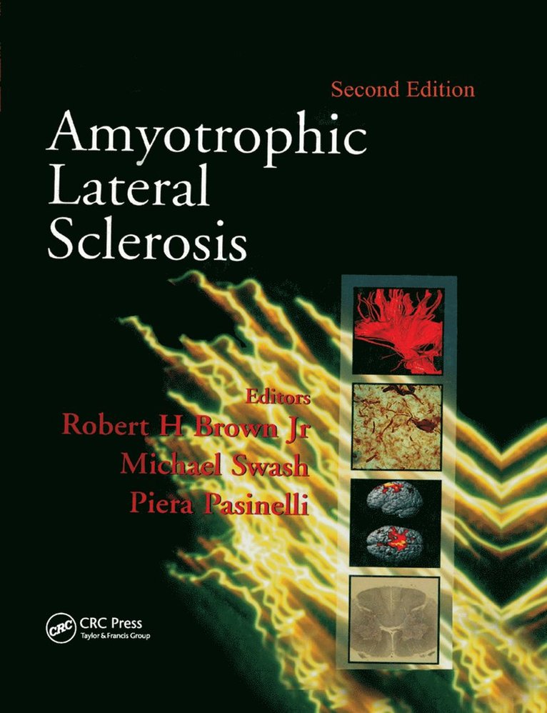 Amyotrophic Lateral Sclerosis, Second Edition 1