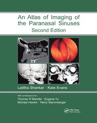 bokomslag Atlas of Imaging of the Paranasal Sinuses, Second Edition