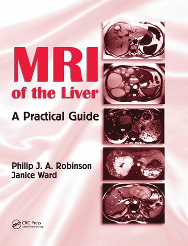 bokomslag MRI of the Liver