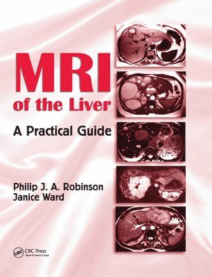 MRI of the Liver 1