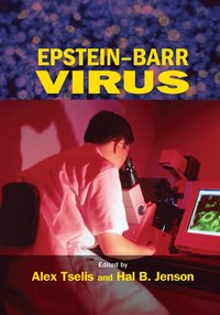 bokomslag Epstein-Barr Virus