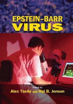 bokomslag Epstein-Barr Virus