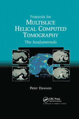 Protocols for Multislice Helical Computed Tomography 1