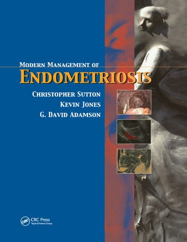 Christopher Sutton, G. David Adamson, Kevin D. Jones - Modern Management of Endometriosis, Häftad