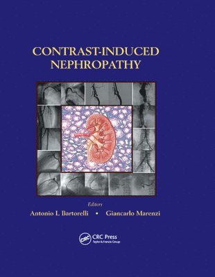 bokomslag Contrast-Induced Nephropathy in Interventional Cardiovascular Medicine