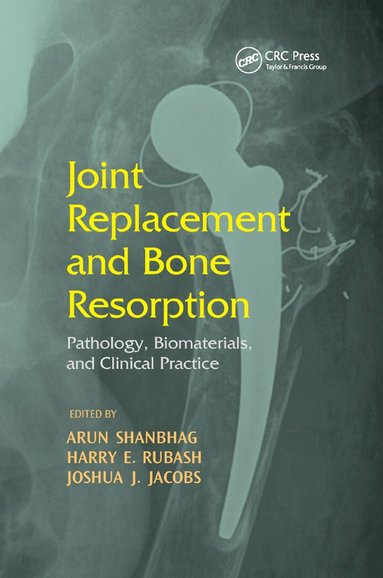 bokomslag Joint Replacement and Bone Resorption