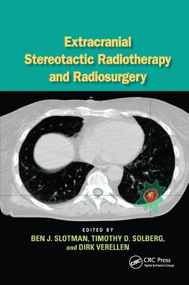 bokomslag Extracranial Stereotactic Radiotherapy and Radiosurgery