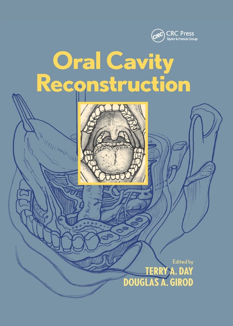 Oral Cavity Reconstruction 1