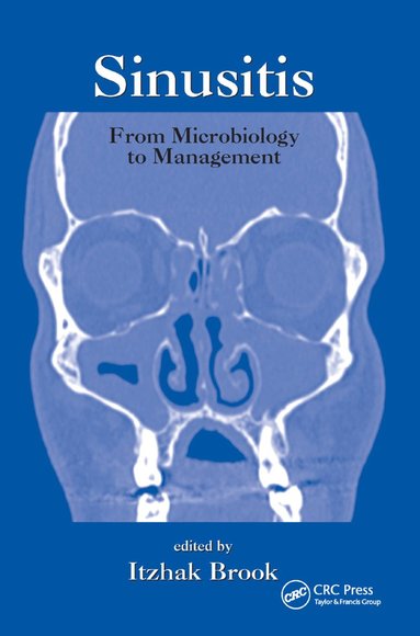 bokomslag Sinusitis