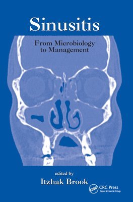 Sinusitis 1