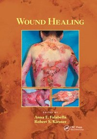 bokomslag Wound Healing