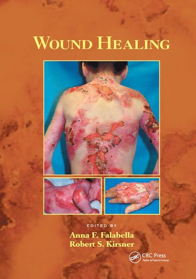 bokomslag Wound Healing