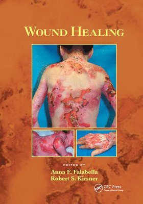 Wound Healing 1
