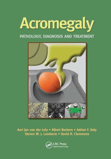 Aart Jan van der Lely, Albert Beckers, Adrian Daly, Steven W. Lamberts, David R. Clemmons - Acromegaly, Häftad