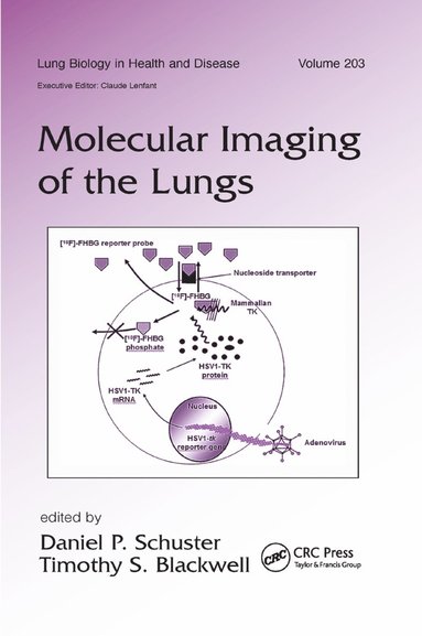 bokomslag Molecular Imaging of the Lungs