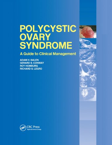 bokomslag Polycystic Ovary Syndrome