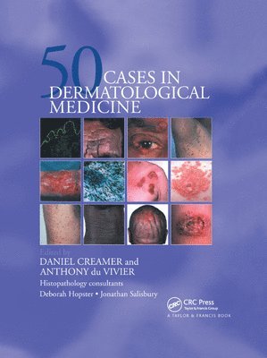 bokomslag Fifty Dermatological Cases