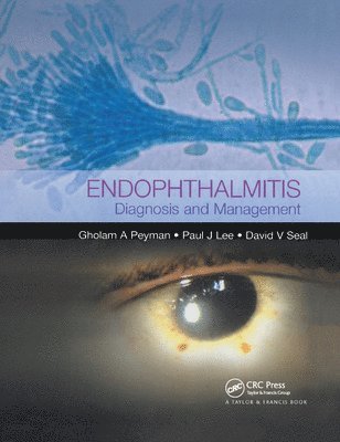 Endophthalmitis 1