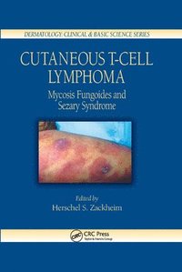 bokomslag Cutaneous T-Cell Lymphoma