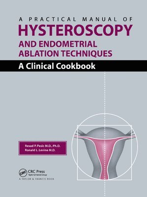 A Practical Manual of Hysteroscopy and Endometrial Ablation Techniques 1