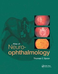 bokomslag Atlas of Neuro-ophthalmology