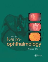 bokomslag Atlas of Neuro-ophthalmology