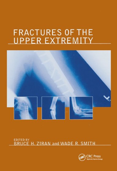 bokomslag Fractures of the Upper Extremity