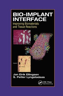 J.E. Ellingsen, S.P. Lyngstadaas, J. E. Ellingsen, S. P. Lyngstadaas - Bio-Implant Interface, Häftad
