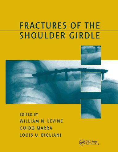 bokomslag Fractures of the Shoulder Girdle