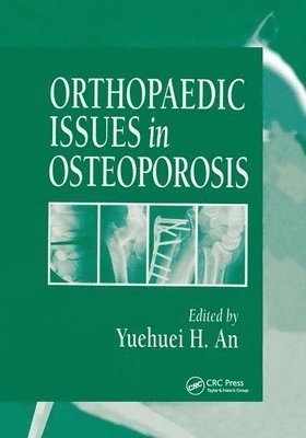 Orthopaedic Issues in Osteoporosis 1