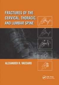 bokomslag Fractures of the Cervical, Thoracic, and Lumbar Spine