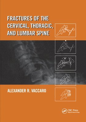 Fractures of the Cervical, Thoracic, and Lumbar Spine 1