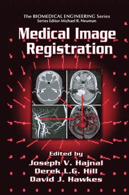 Medical Image Registration 1