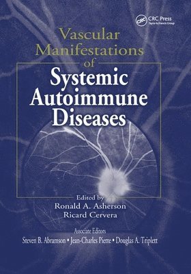 Vascular Manifestations of Systemic Autoimmune Diseases 1