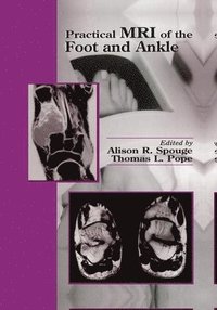 bokomslag Practical MRI of the Foot and Ankle
