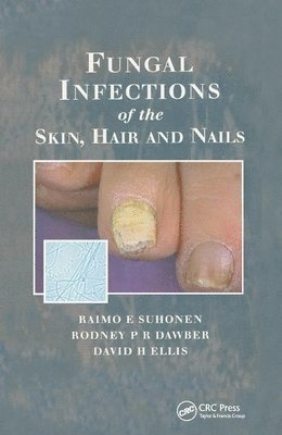 bokomslag Fungal Infections of the Skin and Nails
