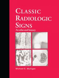 bokomslag Classic Radiologic Signs