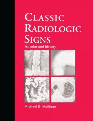 Classic Radiologic Signs 1