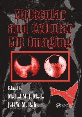 Molecular and Cellular MR Imaging 1