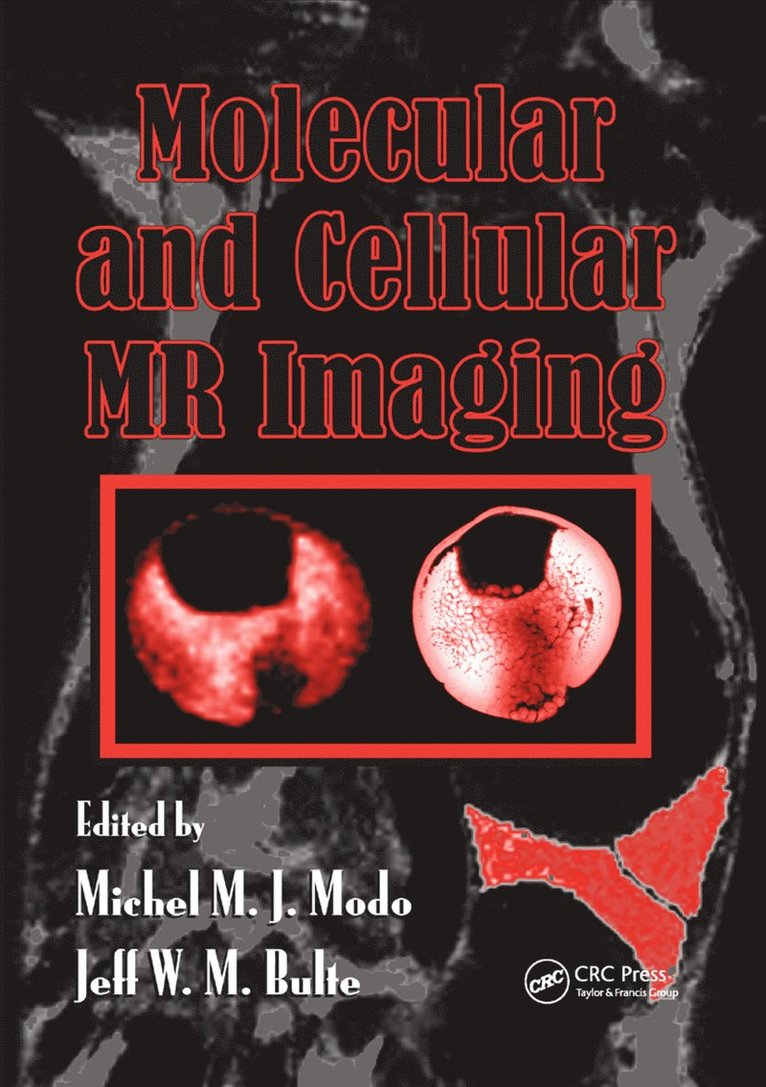 Molecular and Cellular MR Imaging