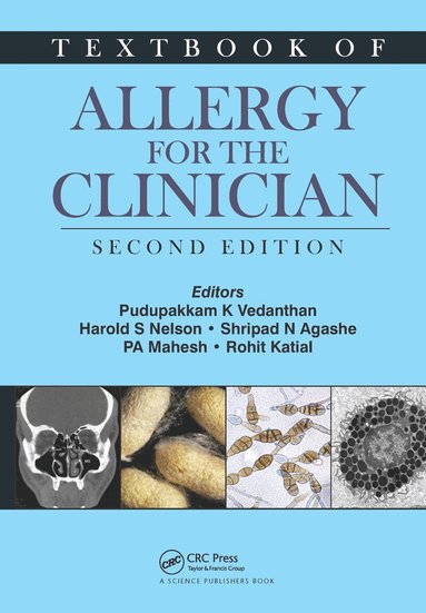 Pudupakkam K. Vedanthan, Harold S. Nelson, Shripad N. Agashe, PA Mahesh, Rohit Katial - Textbook of Allergy for the Clinician, Inbunden