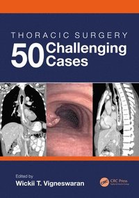 bokomslag Thoracic Surgery: 50 Challenging cases