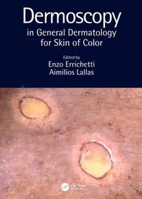 bokomslag Dermoscopy in General Dermatology for Skin of Color