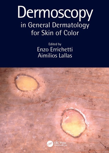 Enzo Errichetti, Aimilios Lallas - Dermoscopy in General Dermatology for Skin of Color, Inbunden